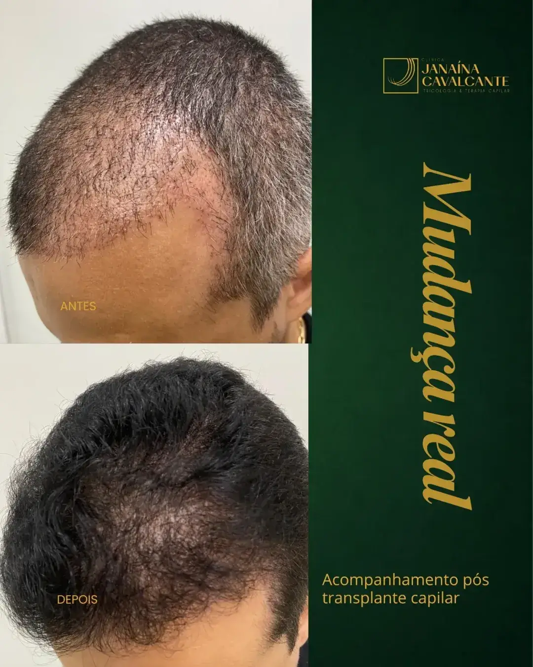 Registro de resultado 01