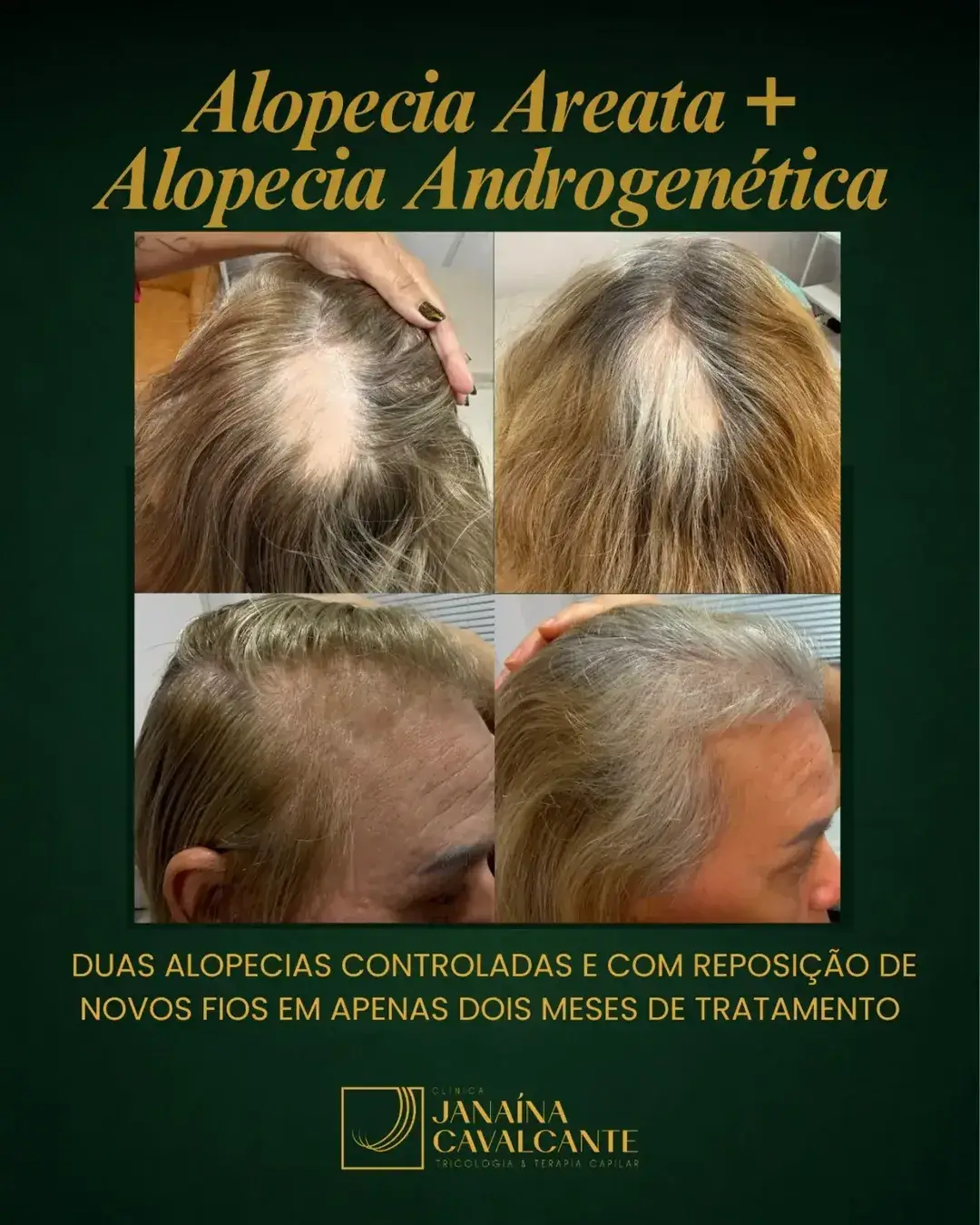Registro de resultado 04