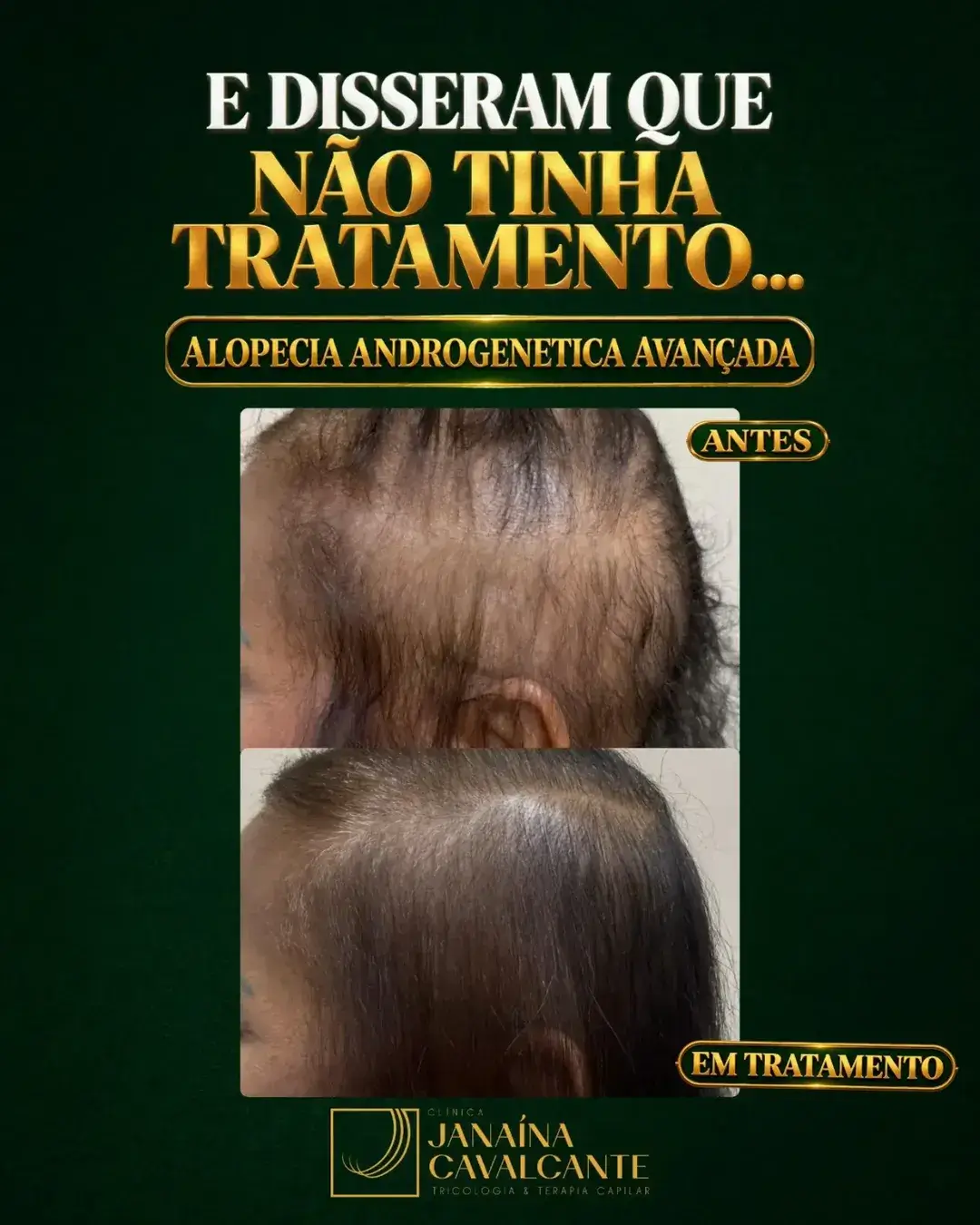 Registro de resultado 07