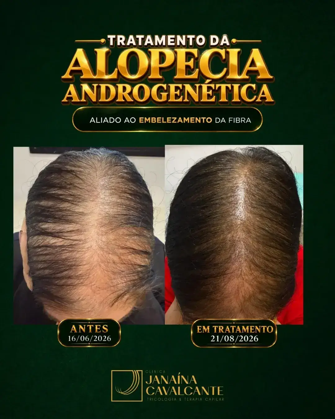 Registro de resultado 08