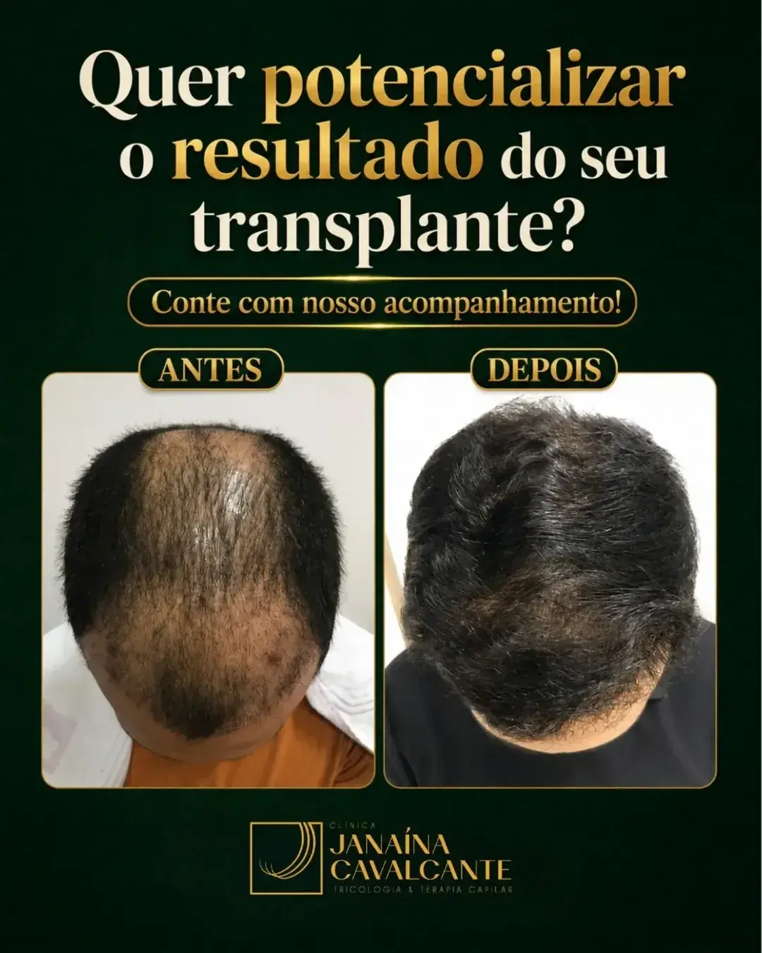 Registro de resultado 10