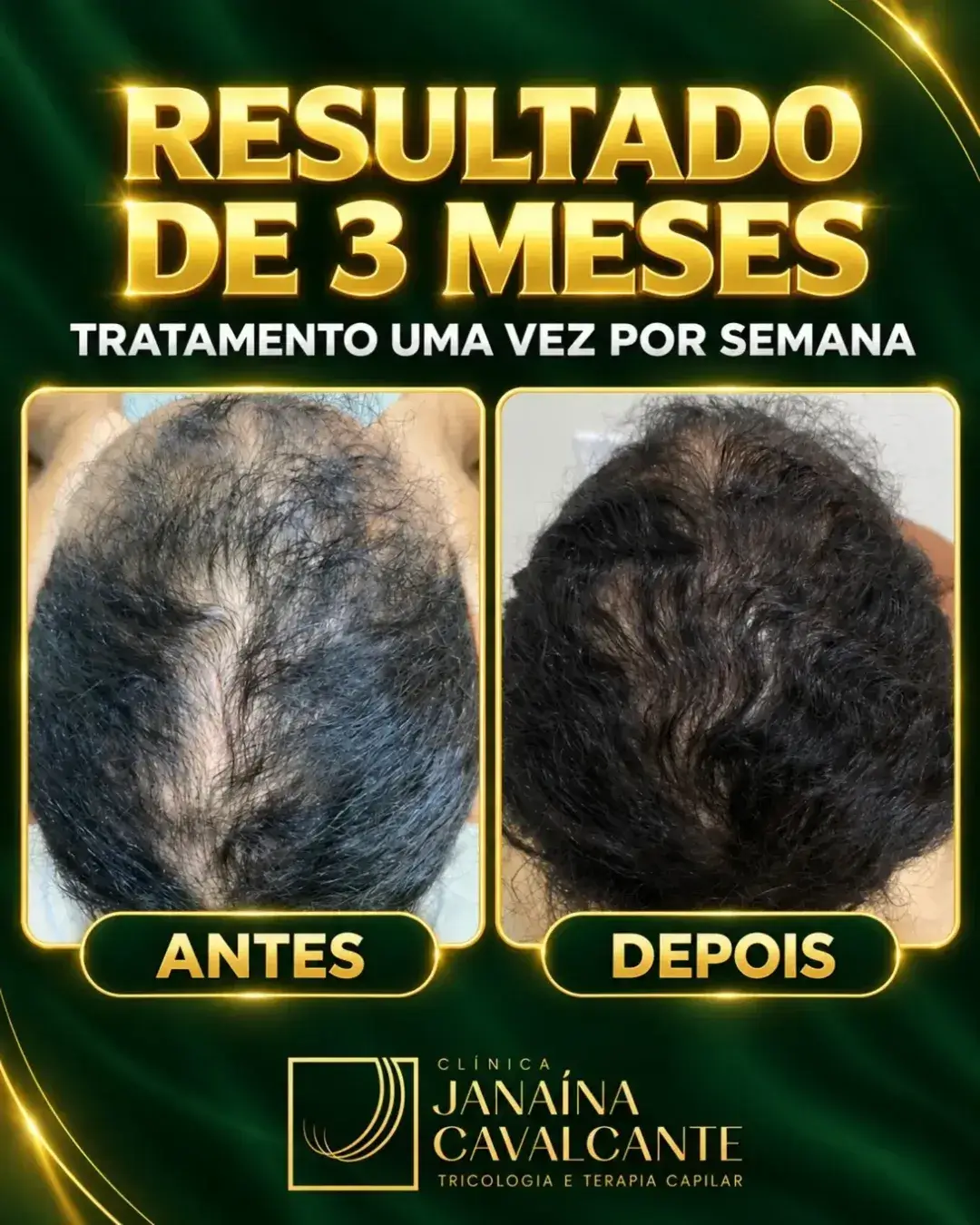 Registro de resultado 12